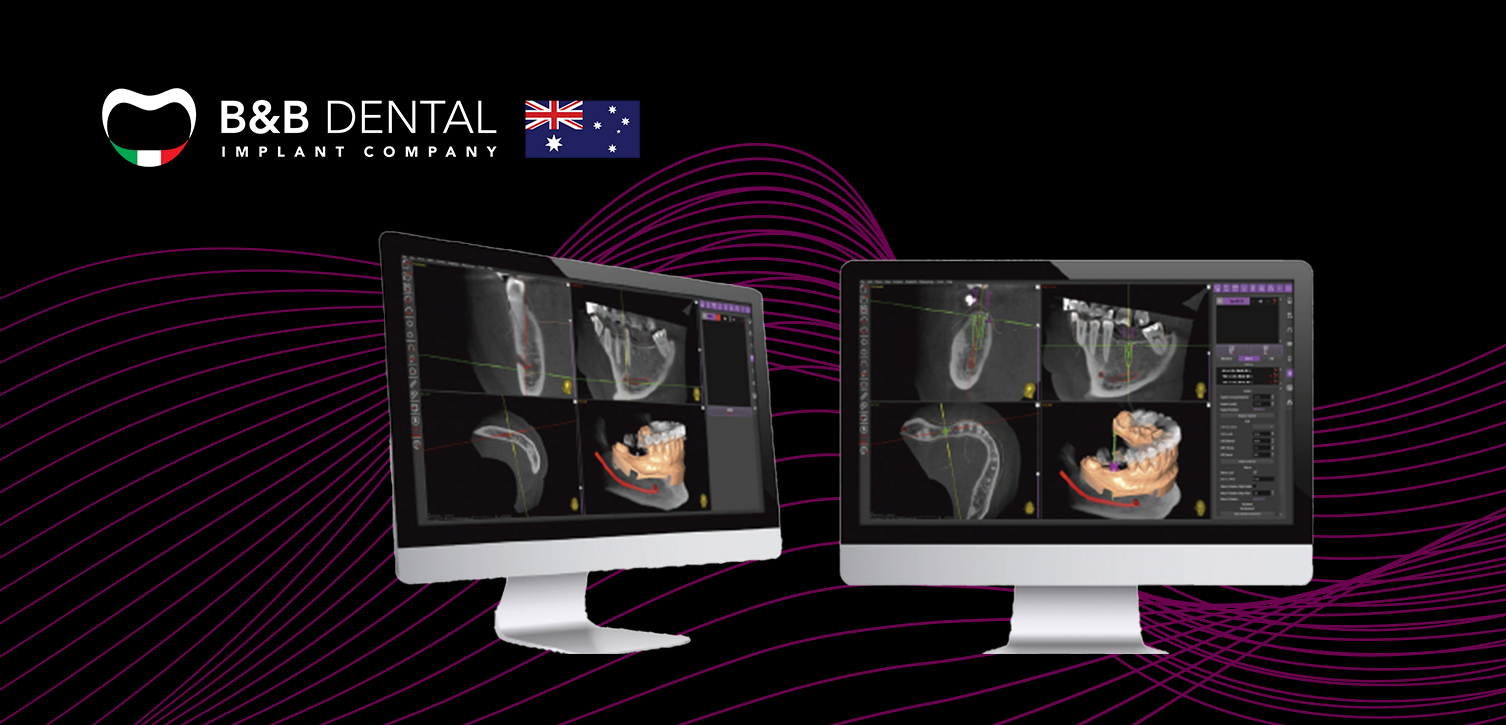 Surgical Guide Planning