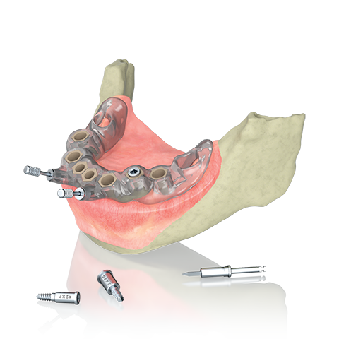 Surgical Guide Planning